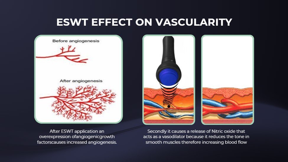 Vascularity